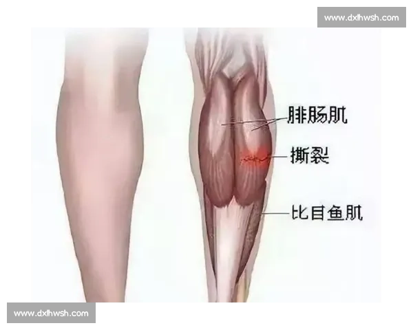 肌肉拉伤的预防方法与康复训练全攻略 肌肉拉伤的预防方法与康复训练全攻略